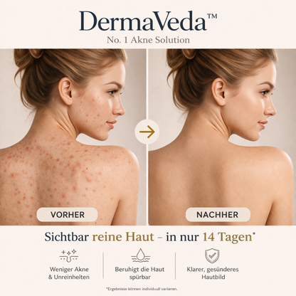 DermaVeda™