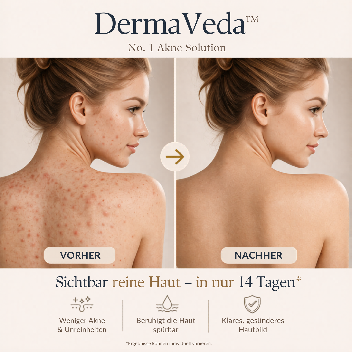 DermaVeda™
