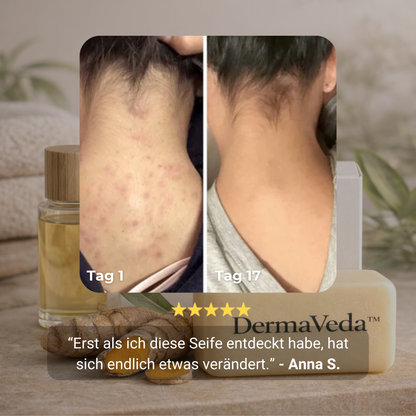 DermaVeda™